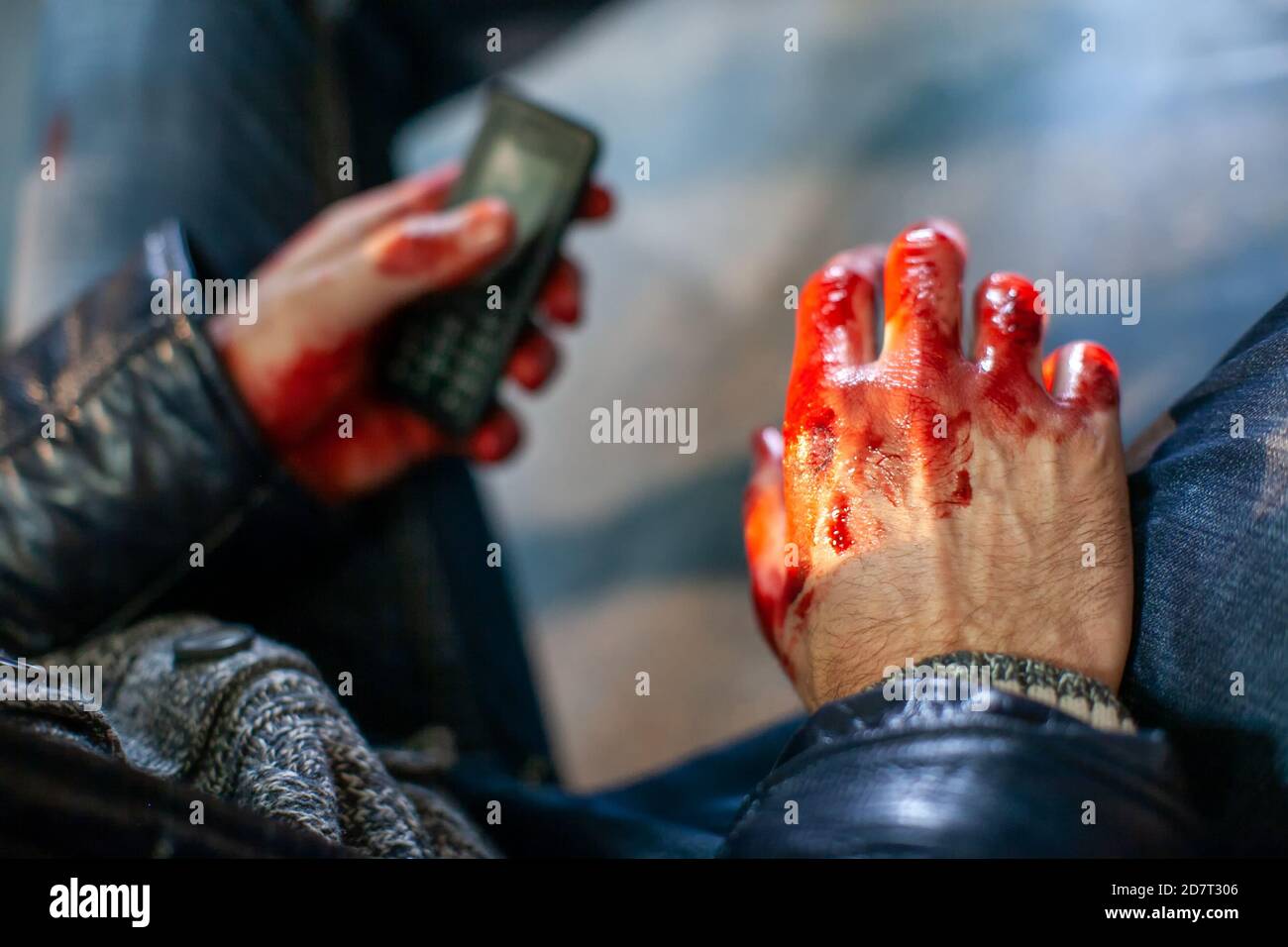 La mano dell'uomo è coperta di sangue dopo un incidente una macchina Foto Stock