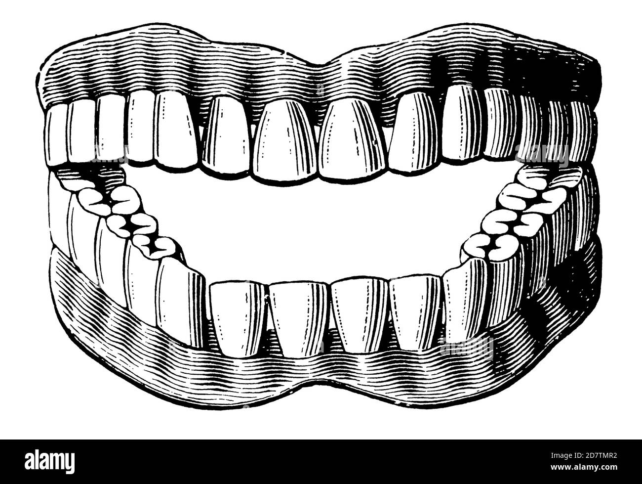 Vintage Dental Advertising - Illustrazione perfetta dei denti bianchi con bocca e lingua dal Vintage Design originale per la terapia e il trattamento dentistico Foto Stock