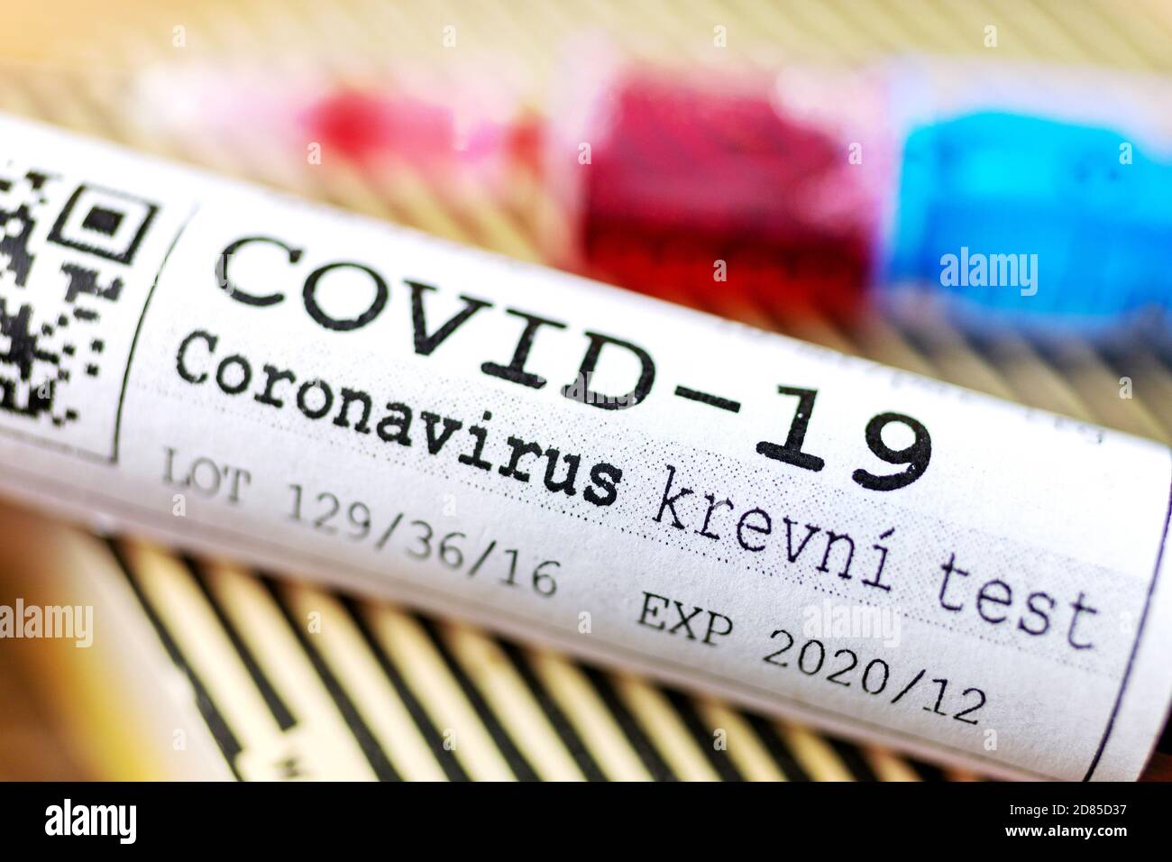 Virus pericoloso del Coronavirus Covid-19 in laboratorio - infezione del virus 2019-nCoV. Rischio pandemico globale dovuto all'epidemia di coronavirus Foto Stock
