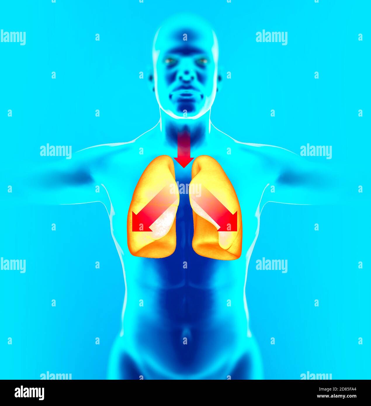 Anatomia del corpo umano, polmoni e tosse. Medicinale per disciogliere il flemma. Effetto del muco che si accumula nel tratto respiratorio. rendering 3d Foto Stock