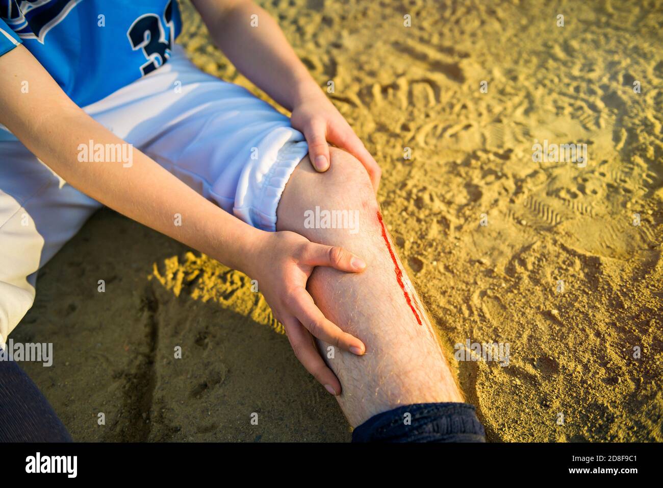 Il bambino pre-teen è stato ferito nello sport di baseball Foto Stock