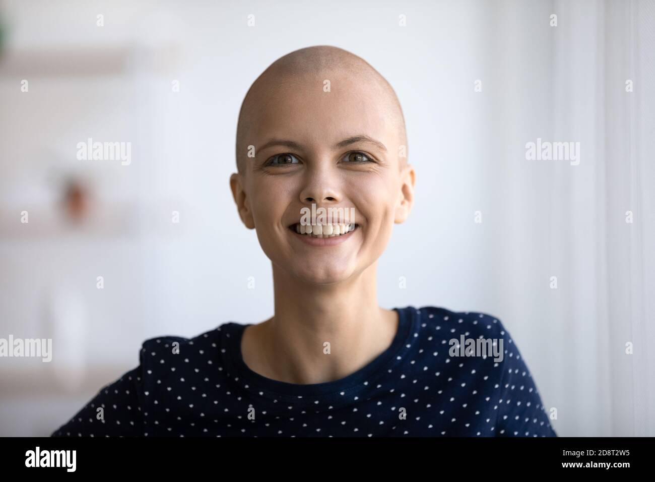 Ritratto con foto in testa che sorrideva una donna senza peli guardando la fotocamera Foto Stock