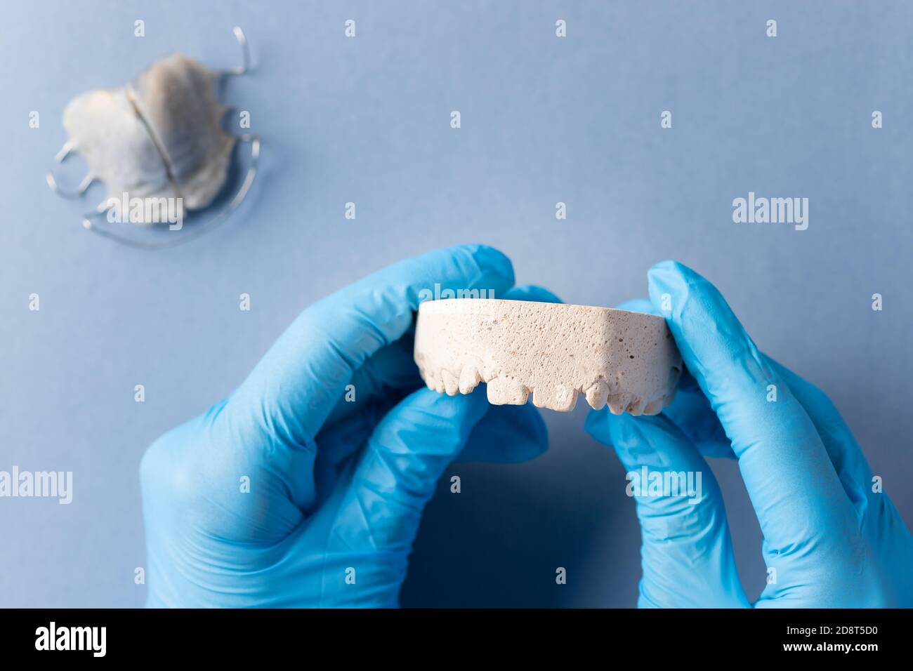 calco di gesso della mascella del bambino nelle mani dell'odontoiatra. odontoiatria pediatrica Foto Stock