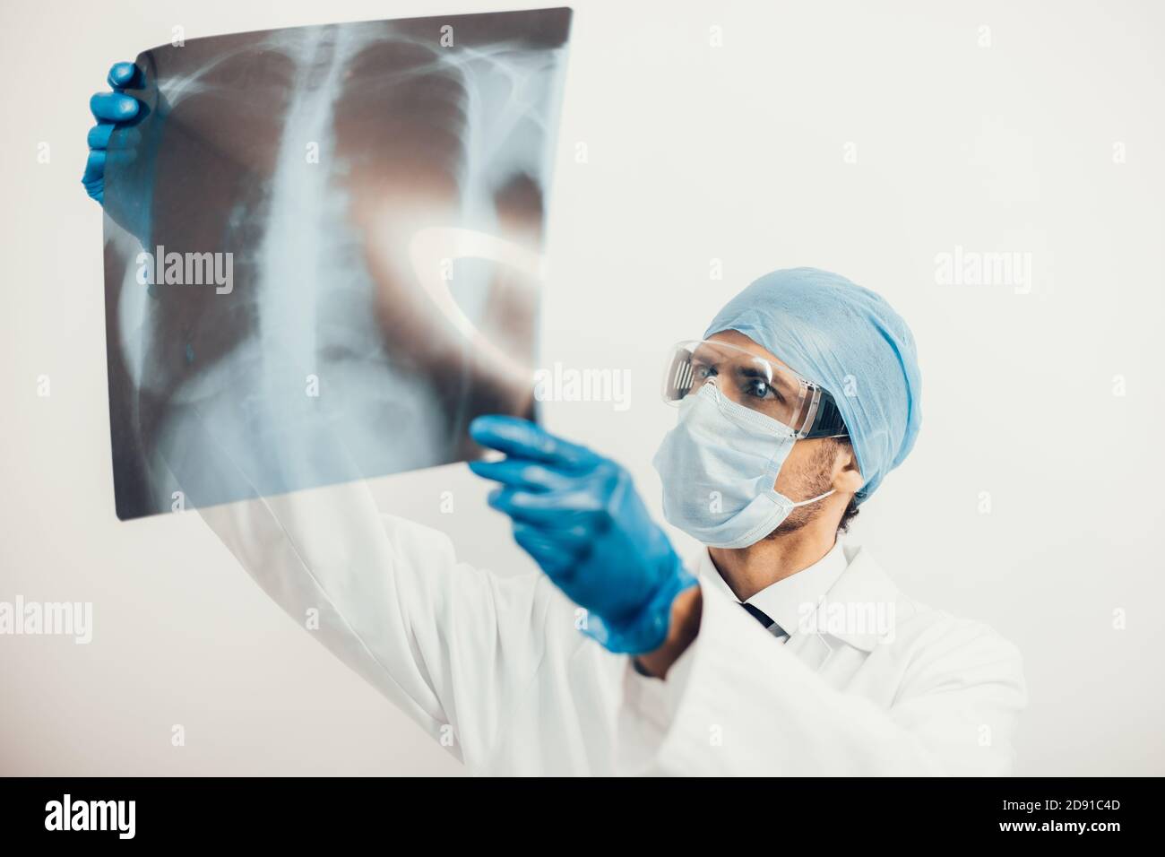 primo piano. medico che guarda i raggi x dei polmoni. Foto Stock