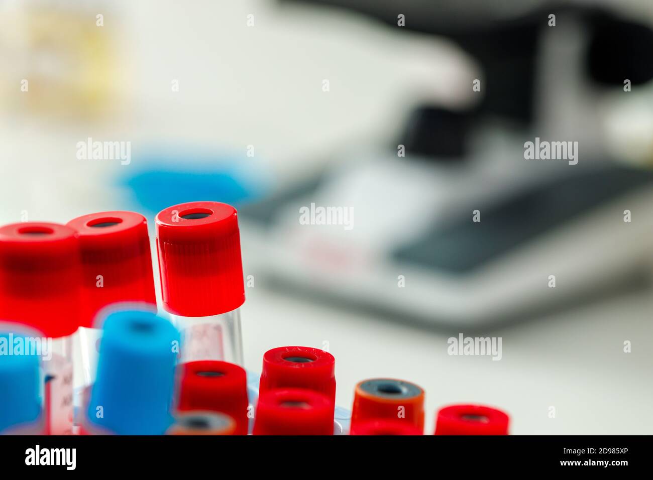 Le provette si trovano in un vassoio da vicino Foto Stock