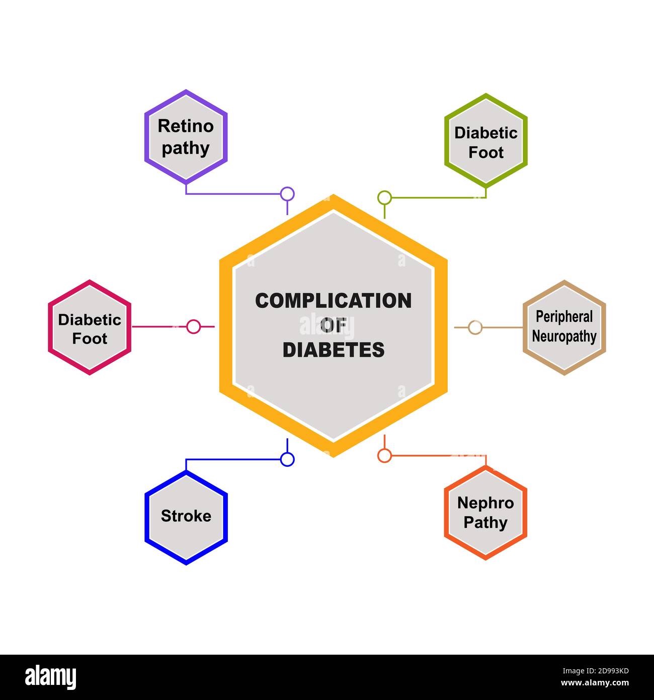 Diagramma di complicazione del diabete con le parole chiavi. EPS 10 - isolato su sfondo bianco Illustrazione Vettoriale