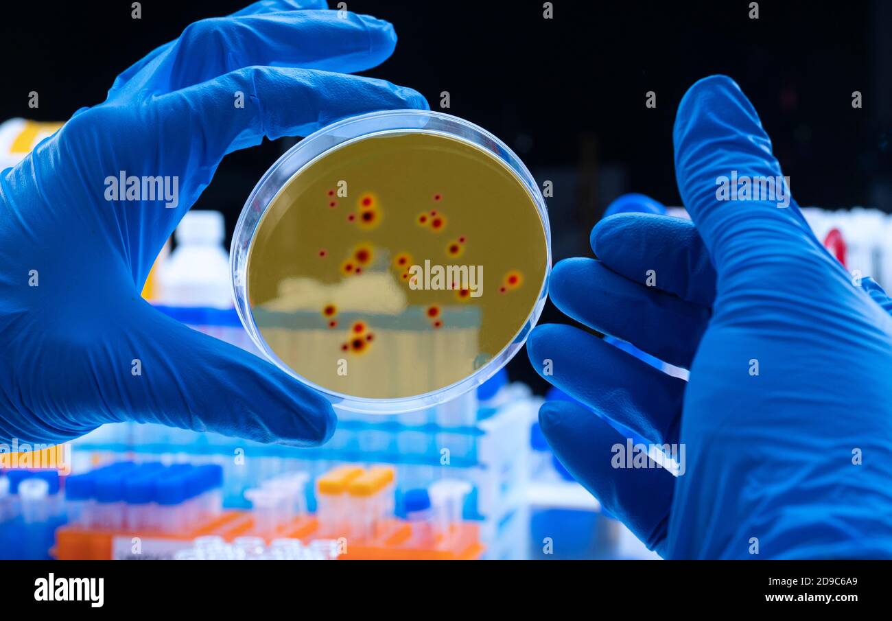Lo scienziato esamina il virus della dengue sulla piastra di Petri in laboratorio, immagine concettuale Foto Stock