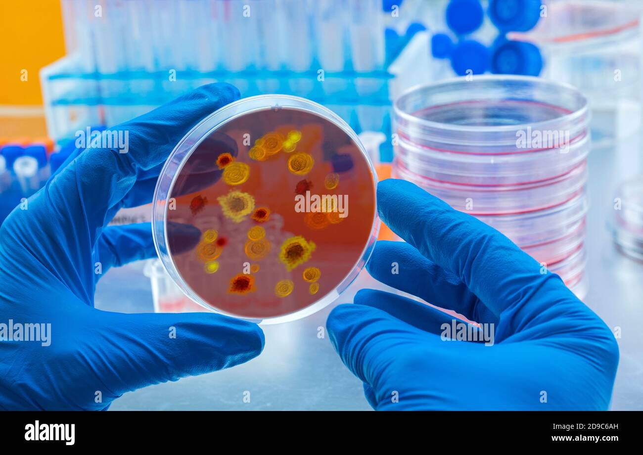 Lo scienziato esamina il virus della dengue sulla piastra di Petri in laboratorio, immagine concettuale Foto Stock