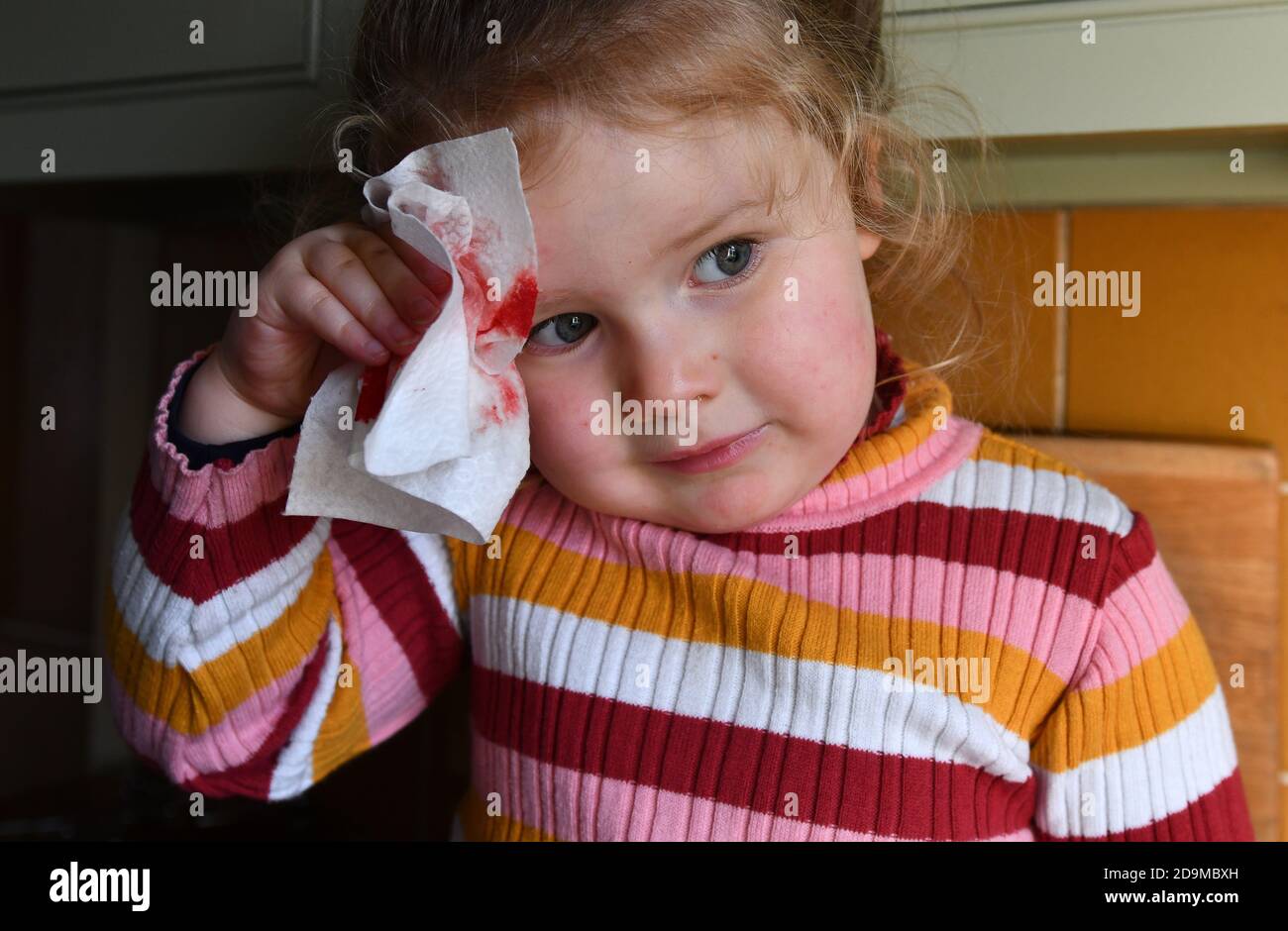 Bambino giovane ragazza che allatta una ferita dopo caduta a casa Foto Stock