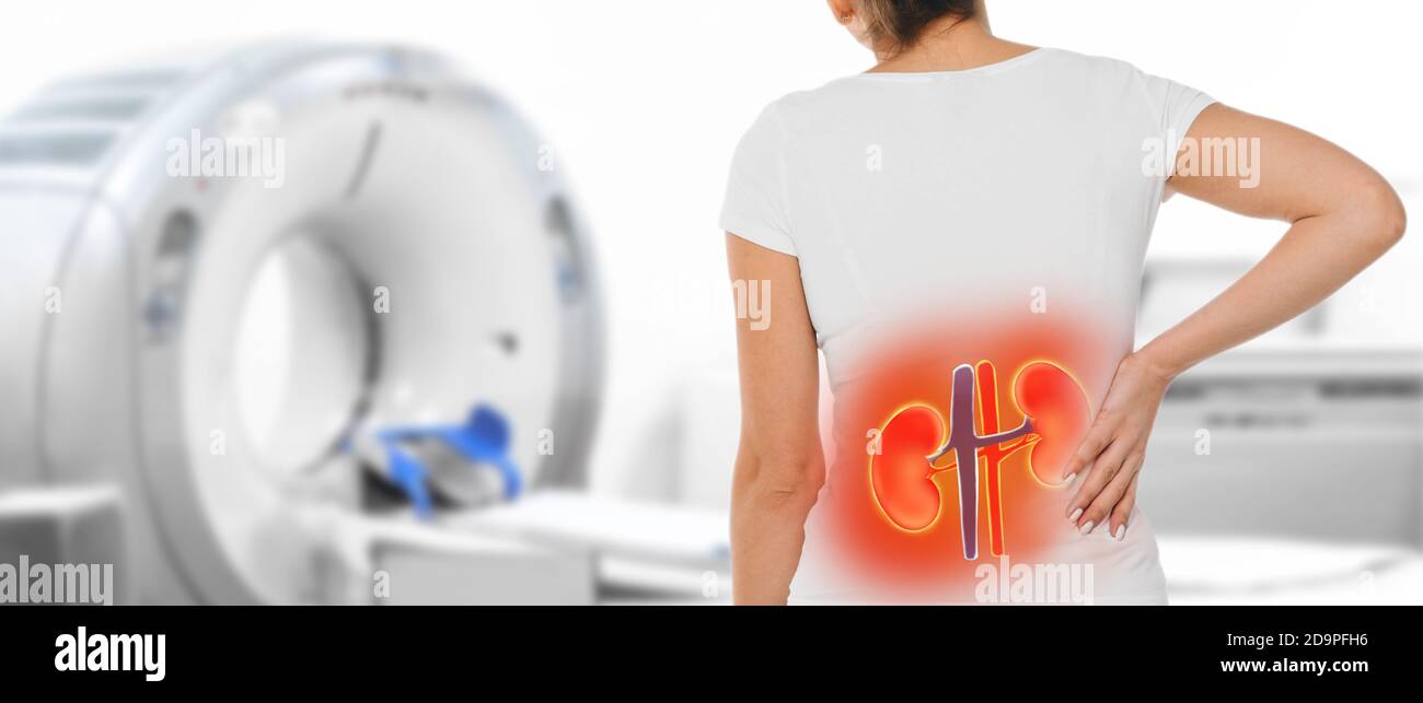 Poster della medicina per il rene della scansione TC. Donna con dolore renale in piedi vicino ad una macchina di tomografia Foto Stock