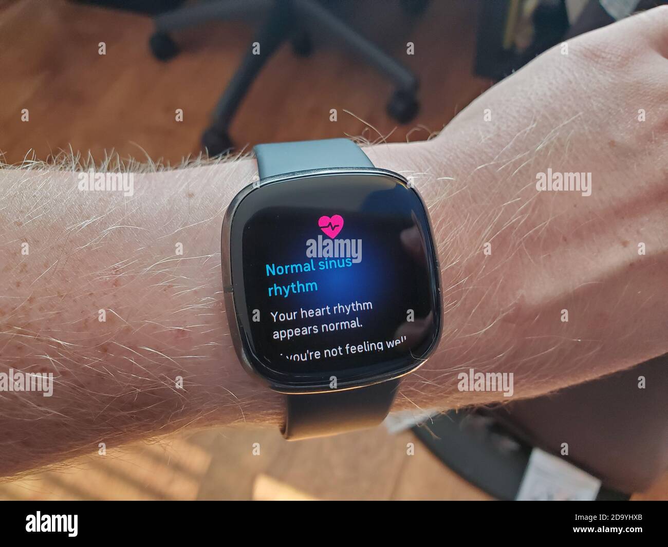 Orologio Fitbit Sense intelligente su braccio di un uomo, che mostra ECG funzione di salute del cuore, San Ramon, California, 8 ottobre 2020. () Foto Stock