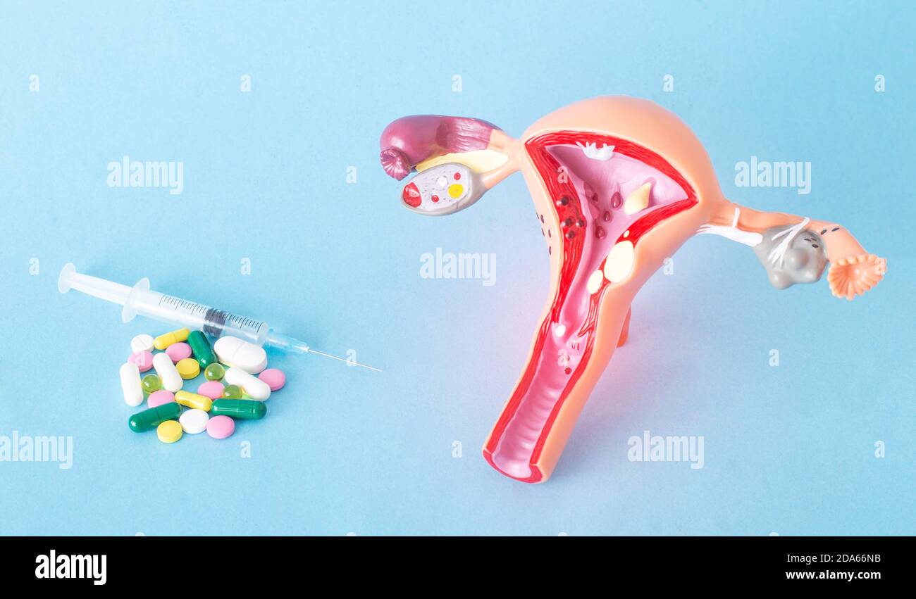 Mock up del sistema riproduttivo femminile e un mazzo di pillole e iniezioni su uno sfondo blu. Concetto di trattamento farmacologico delle infezioni genitali, A. Foto Stock