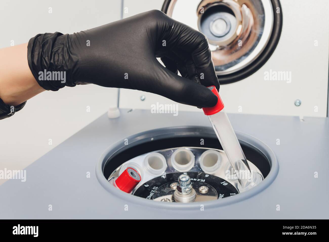 Plasma Platelet-Rich preparazione. Il tubo con il sangue nelle mani. Centrifuga. Sfondo. Foto Stock