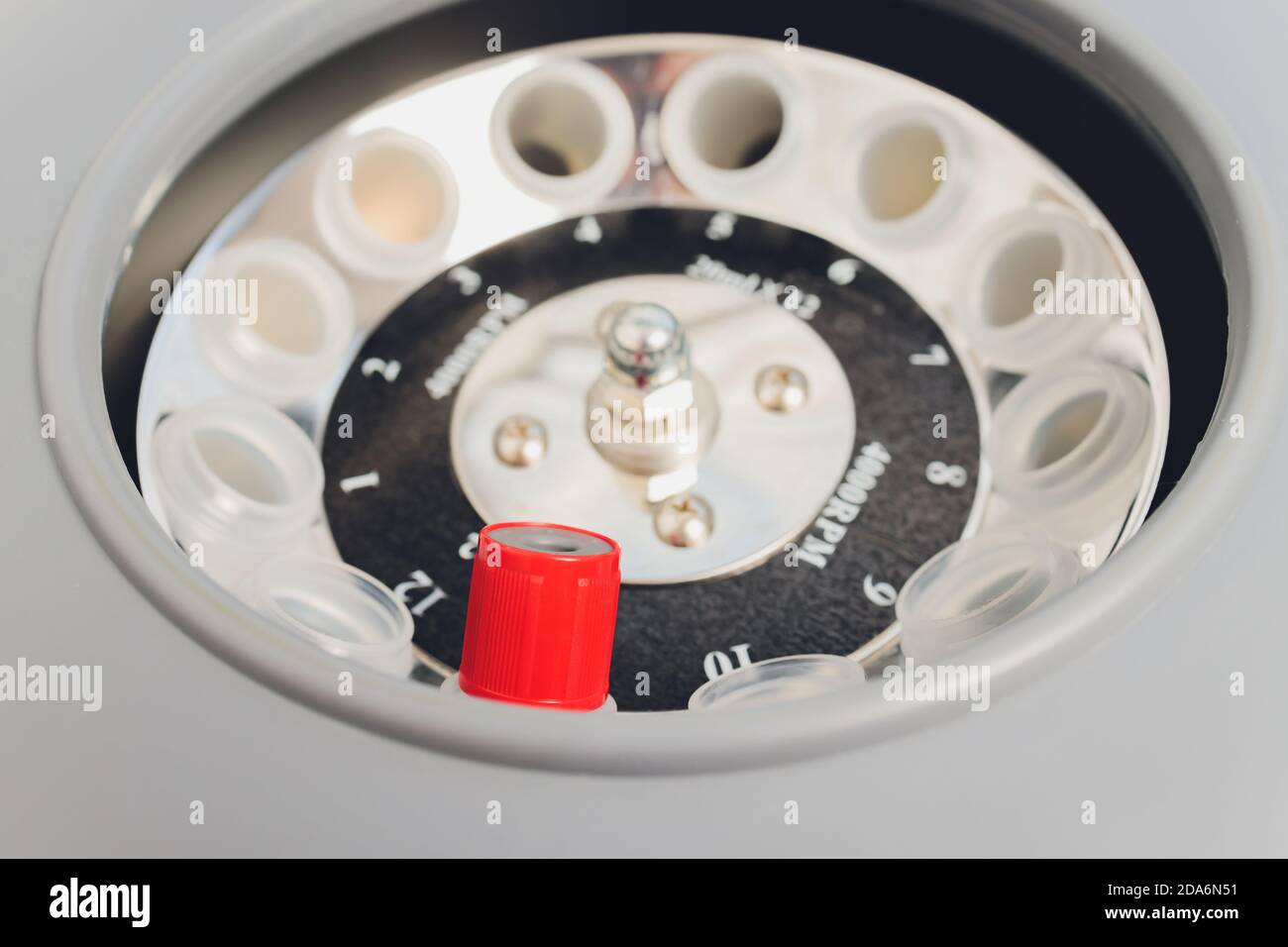 Plasma Platelet-Rich preparazione. Il tubo con il sangue nelle mani. Centrifuga. Sfondo. Foto Stock