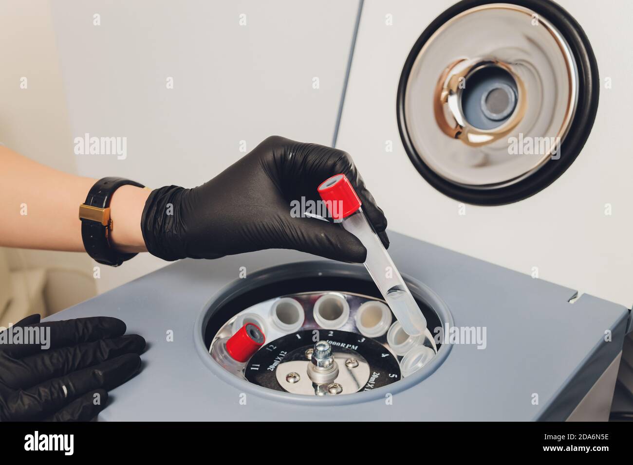 Plasma Platelet-Rich preparazione. Il tubo con il sangue nelle mani. Centrifuga. Sfondo. Foto Stock