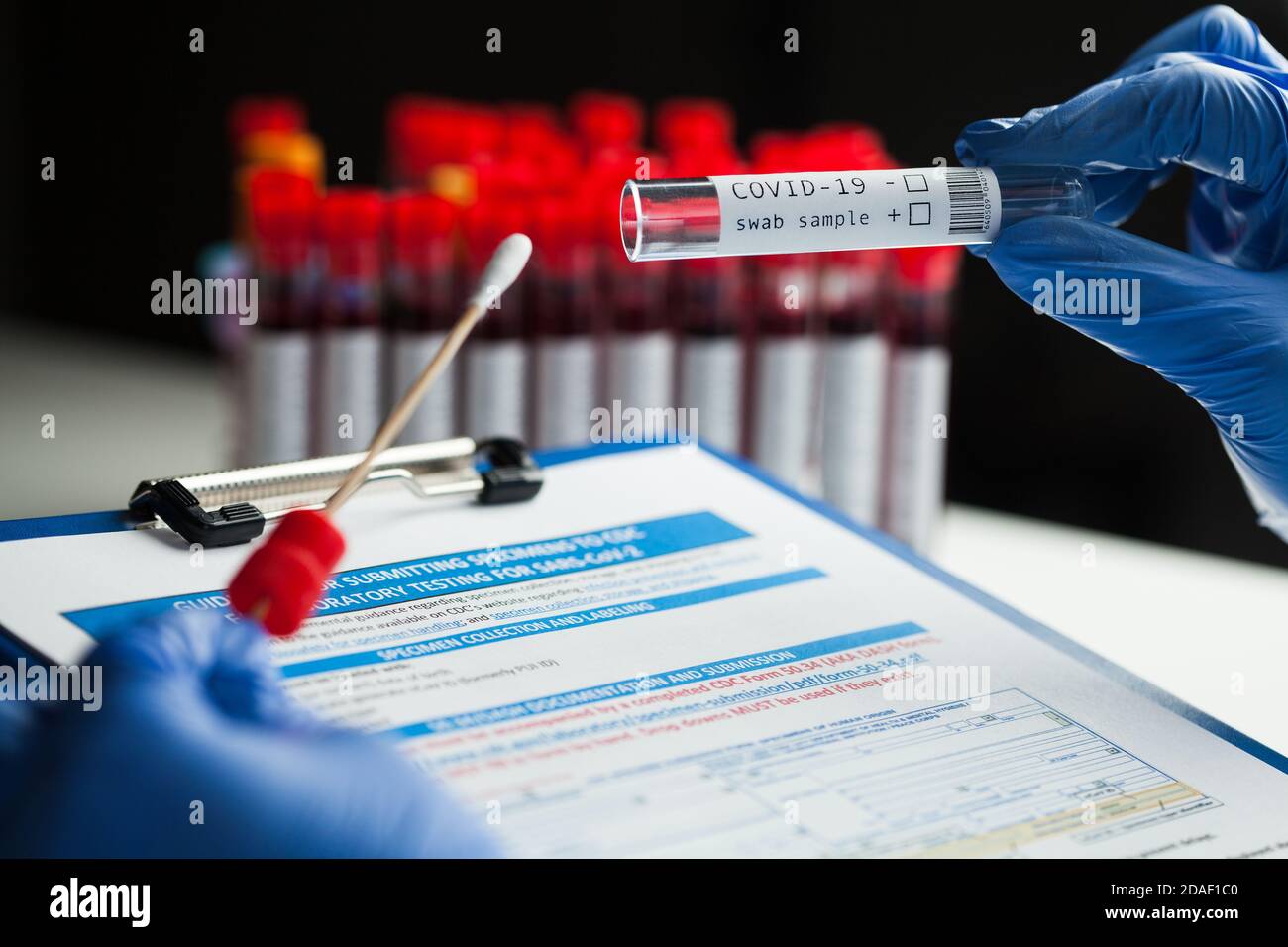 rt-PCR test diagnostico della malattia da virus COVID19, tecnico di laboratorio che indossa protettivo blu guanti per provette con bastoncino di swabbing, apparecchiatura per campioni con tampone Foto Stock