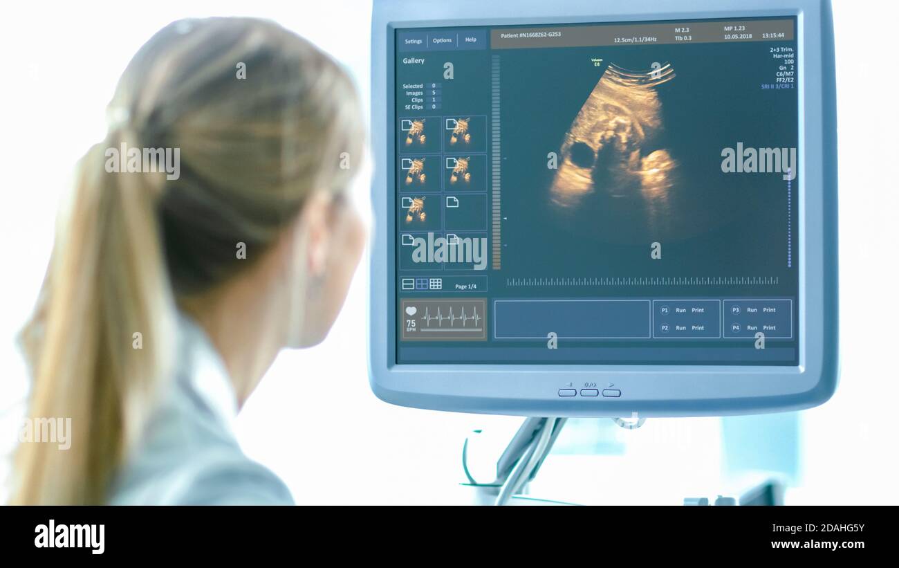 In ospedale, l'ostetrista utilizza il trasduttore per la scansione ecografica dello screening ecografico ventaglio della donna incinta. Lo schermo del computer mostra l'immagine 3D Foto Stock
