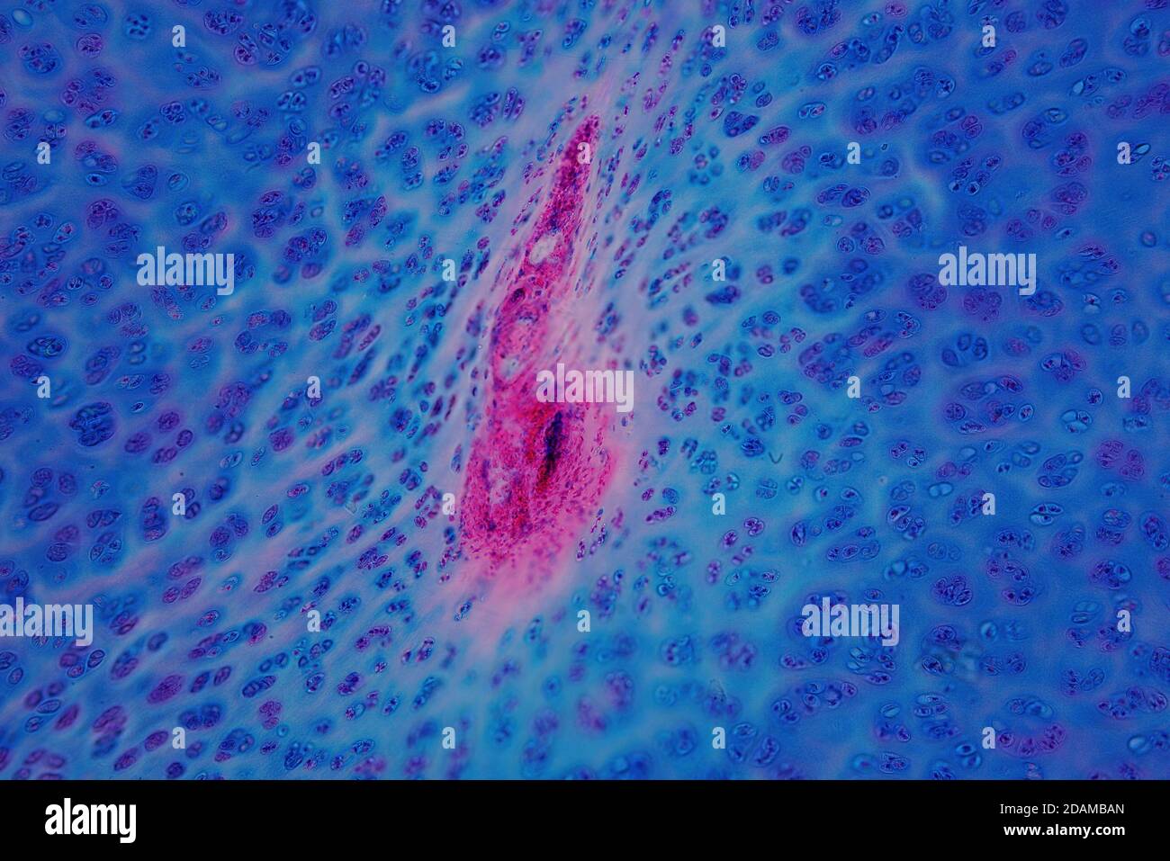 Cartilagine ialina umana, micrografia leggera. Foto Stock