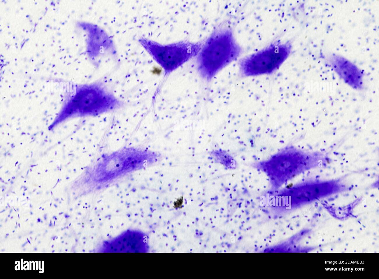 Micrografia chiara delle cellule nervose (grandi, viola) e delle cellule di supporto (neuroglia, punti blu scuro). Ramificazione dal corpo nervo sono dendriti. Foto Stock