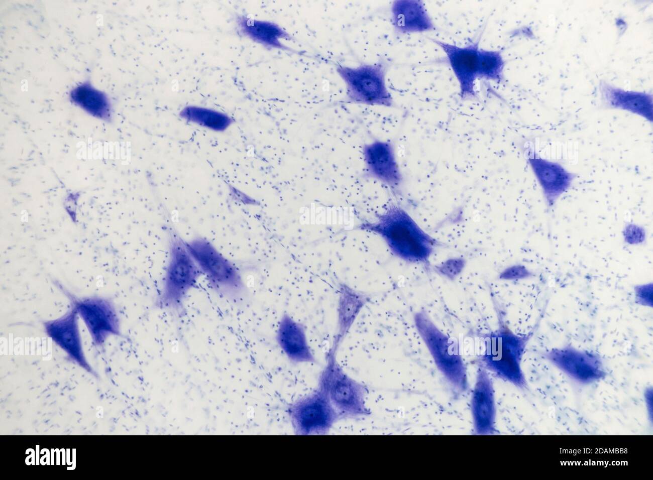 Micrografia chiara delle cellule nervose (grandi, blu) e delle cellule di supporto (neuroglia, punti blu scuro). Ramificazione dal corpo nervo sono dendriti. Foto Stock