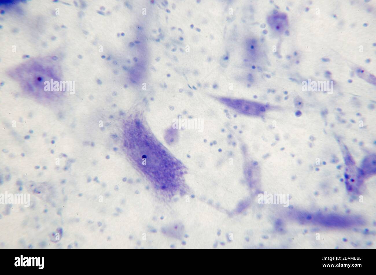 Micrografia chiara delle cellule nervose (grandi, viola) e delle cellule di supporto (neuroglia, punti blu scuro). Ramificazione dal corpo nervo sono dendriti. Foto Stock