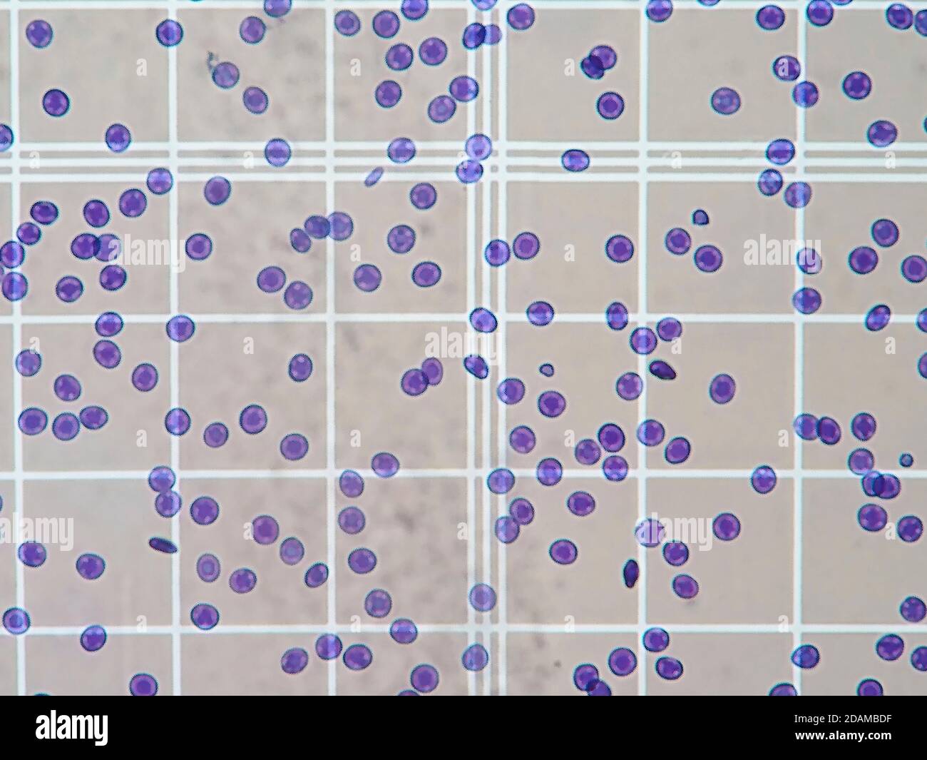 Cellule del sangue in una camera di conteggio sotto un microscopio leggero. Foto Stock