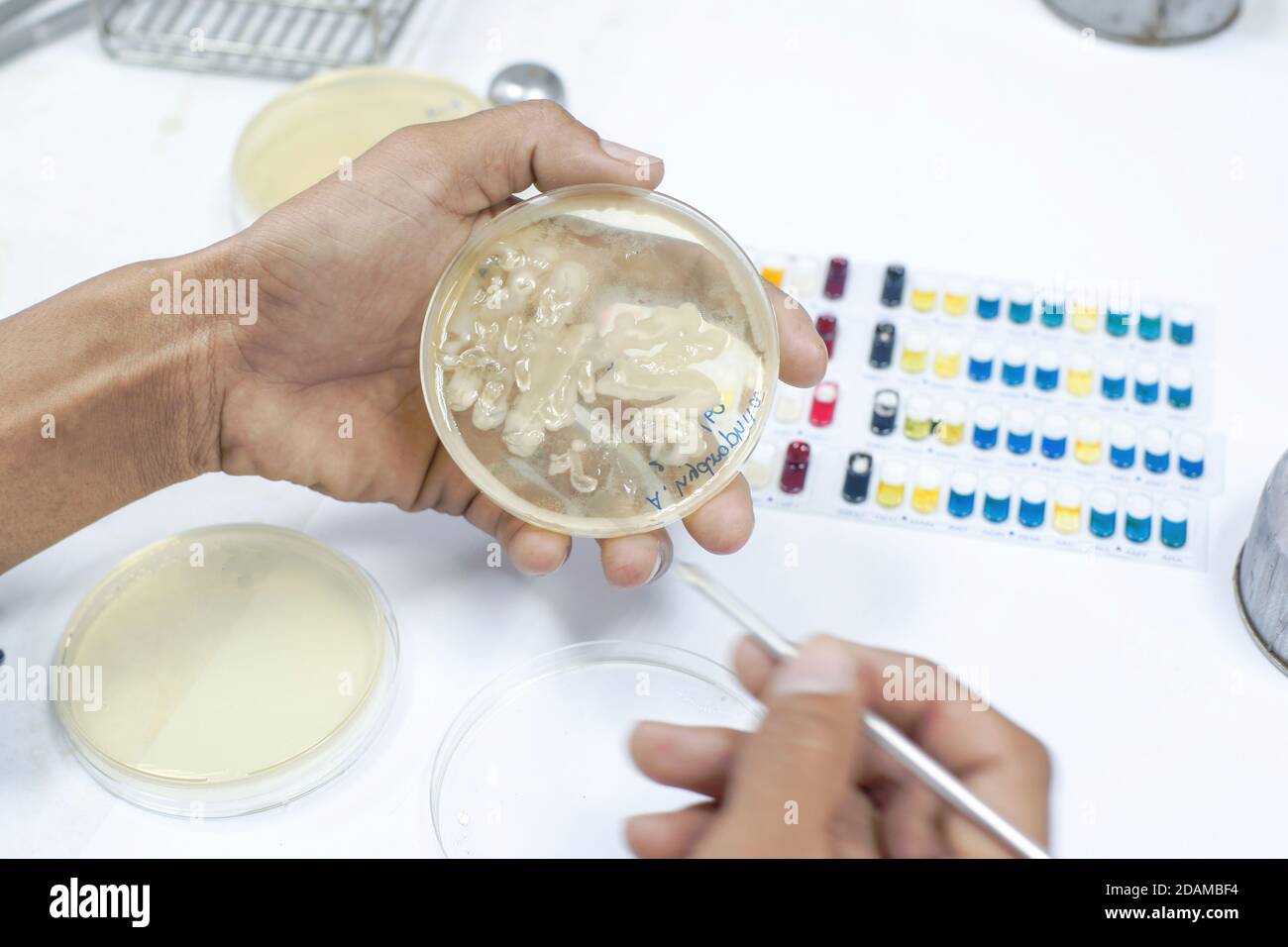 Microbiologo che identifica i batteri su una piastra di agar. Foto Stock
