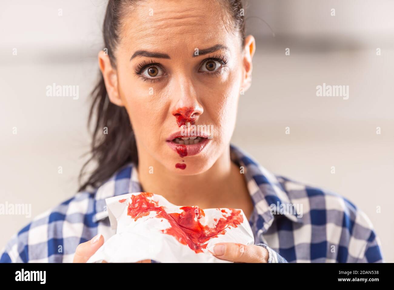 Sangue dal naso immagini e fotografie stock ad alta risoluzione - Alamy