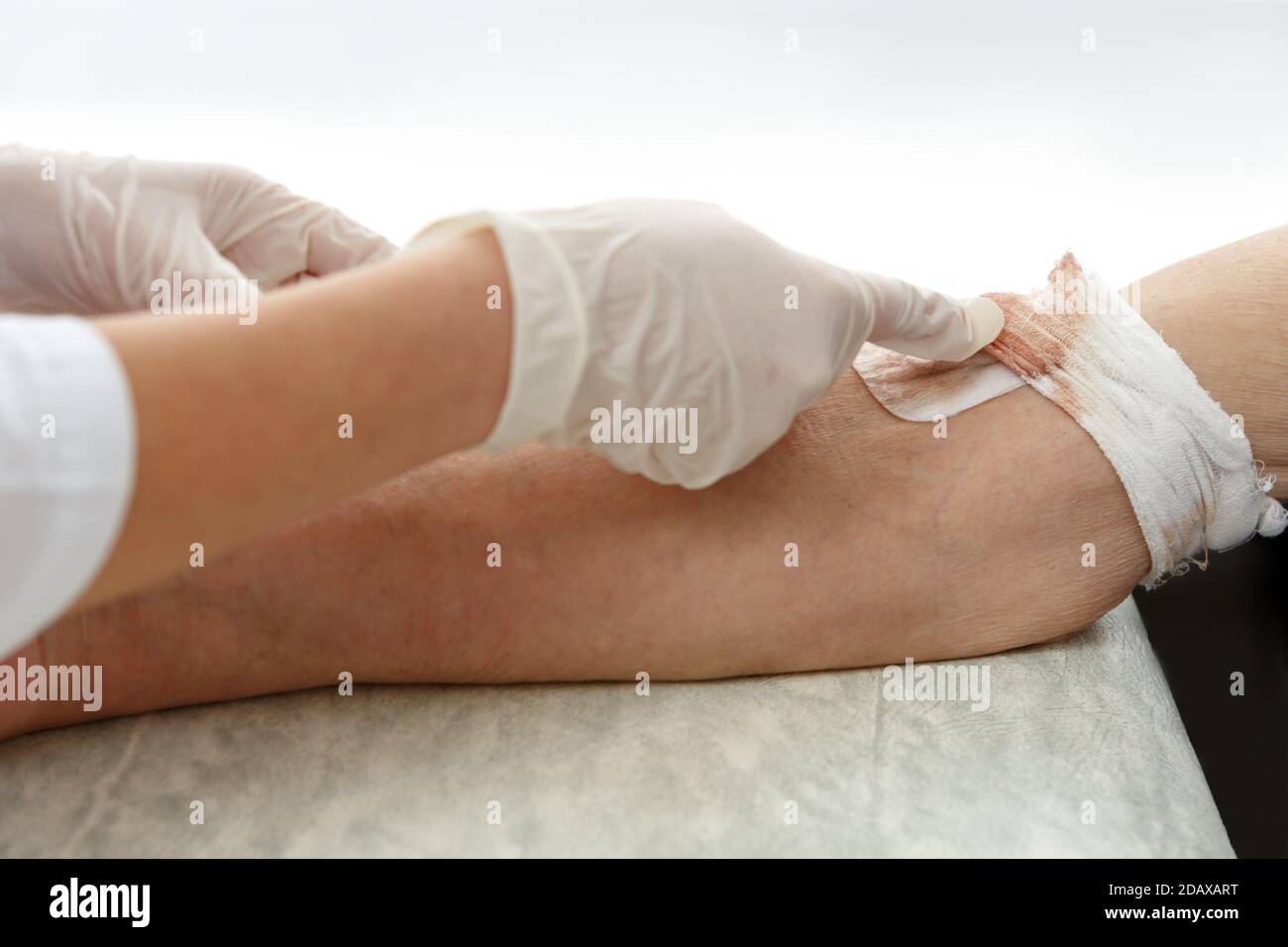 L'infermiere nei guanti inserisce l'ago nel paziente primo piano della vena Foto Stock