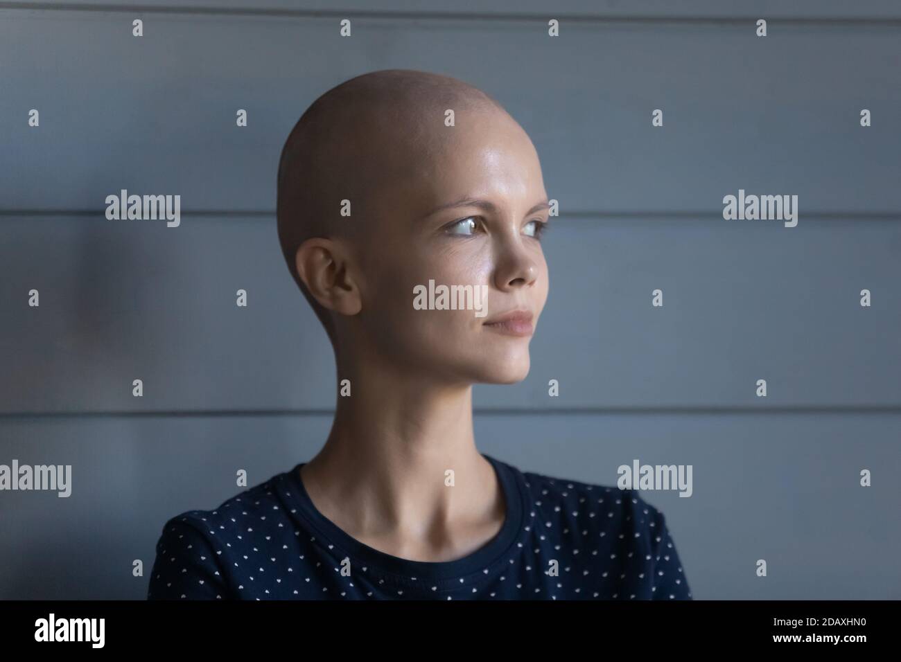Concentrata giovane donna diagnosticata con oncologia guardare avanti con coraggio Foto Stock