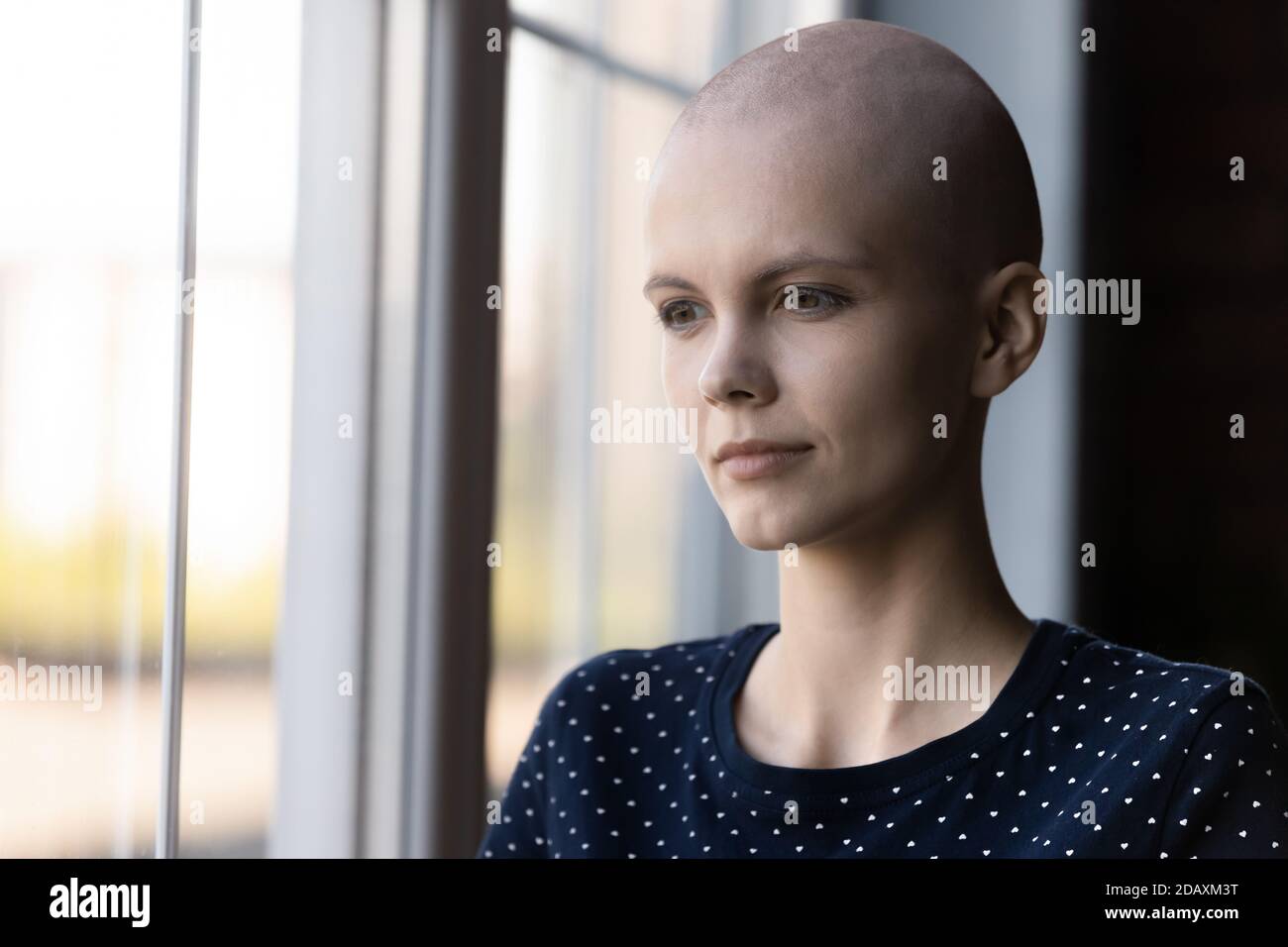 Ha sottolineato giovani donne che soffrono di oncologia cercando di essere forte Foto Stock