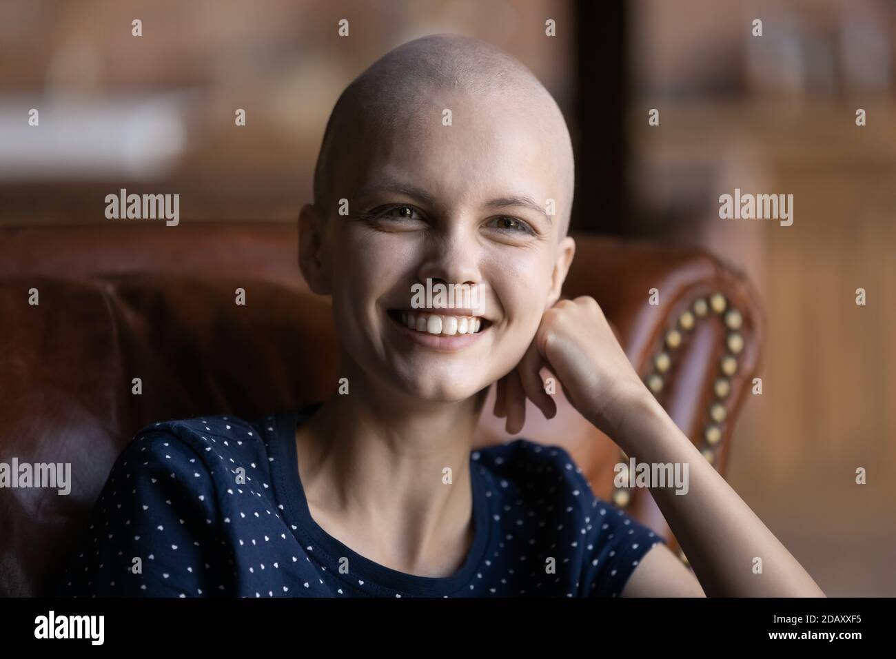 Ridendo donna senza capelli seduta sul divano sentirsi felice di recupero Foto Stock