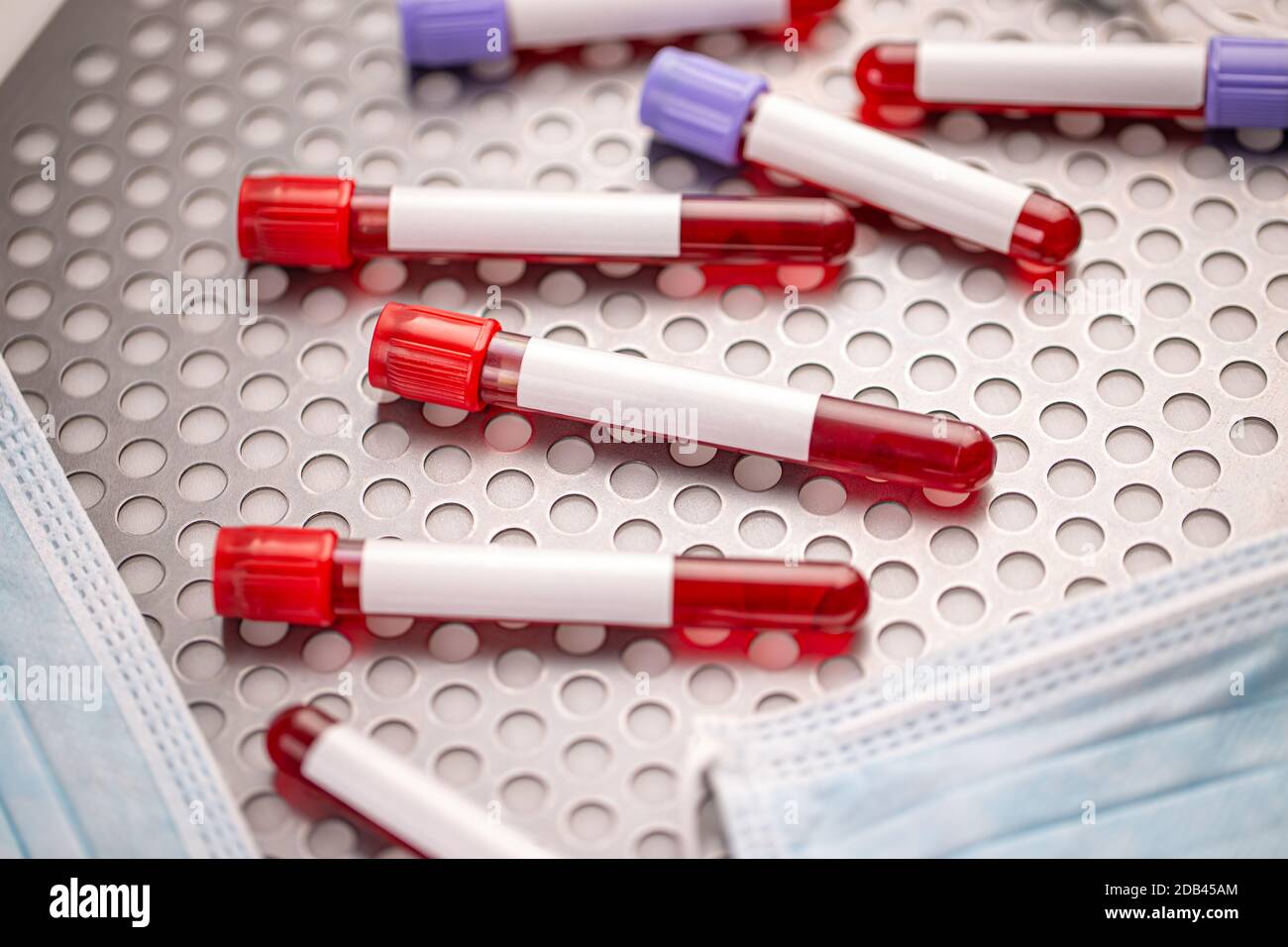 Provette con campioni di sangue su superficie metallica Foto Stock