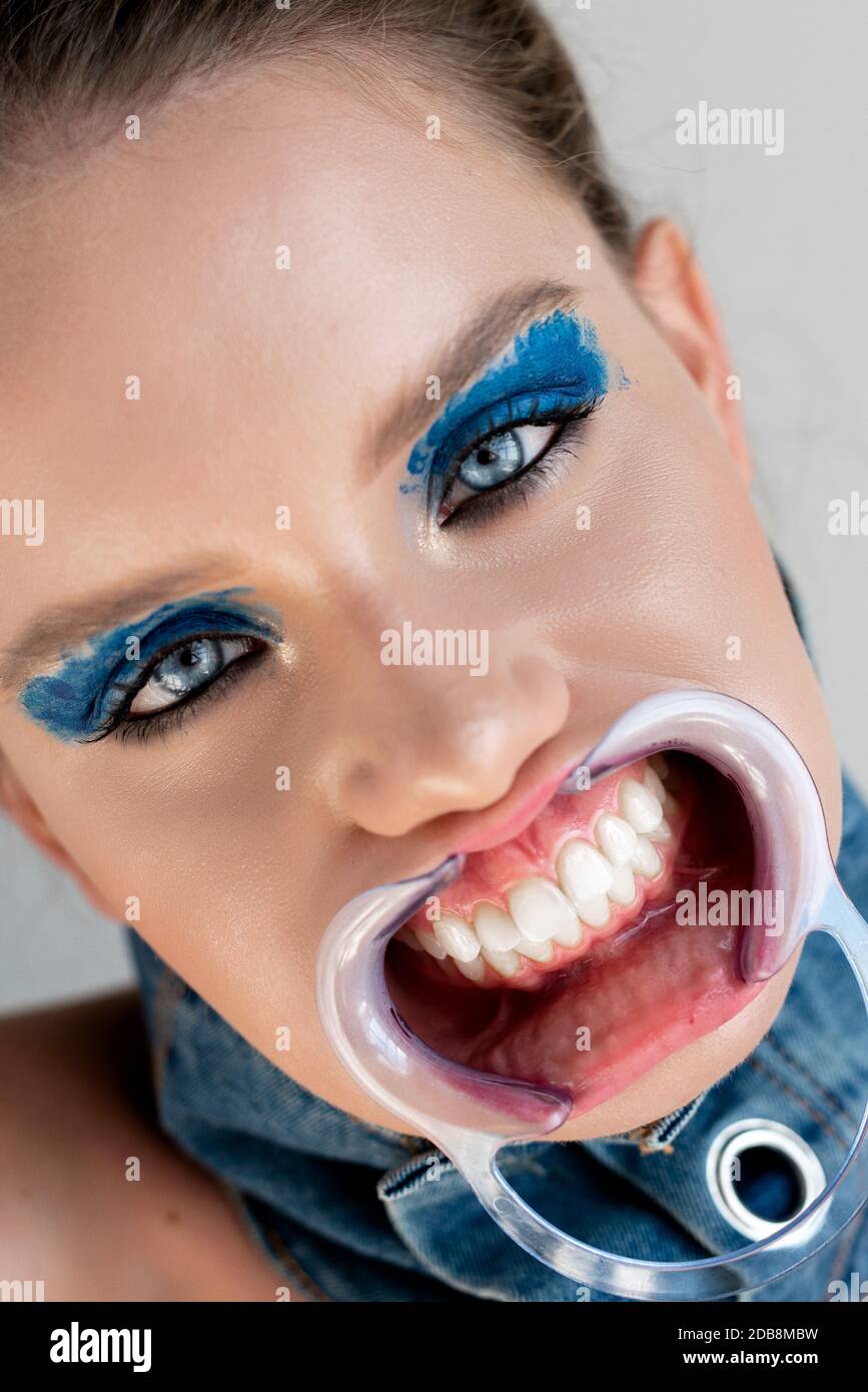 Ritratto di una donna che indossa un divaricatore per bocca dentale Foto  stock - Alamy