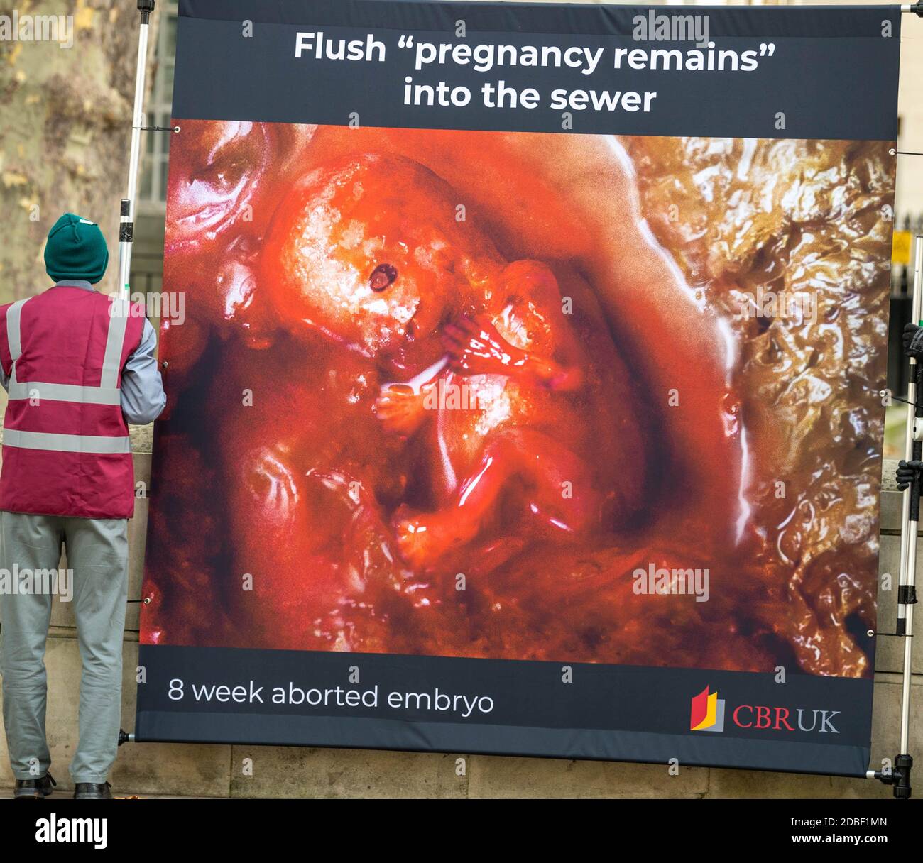 Londra, Regno Unito. 17 Nov 2020. (Warning graphic images) una protesta contro l'aborto del Centre for bio-Ethical Reform, UK, di fronte a Downing Street, Londra UK Credit: Ian Davidson/Alamy Live News Foto Stock