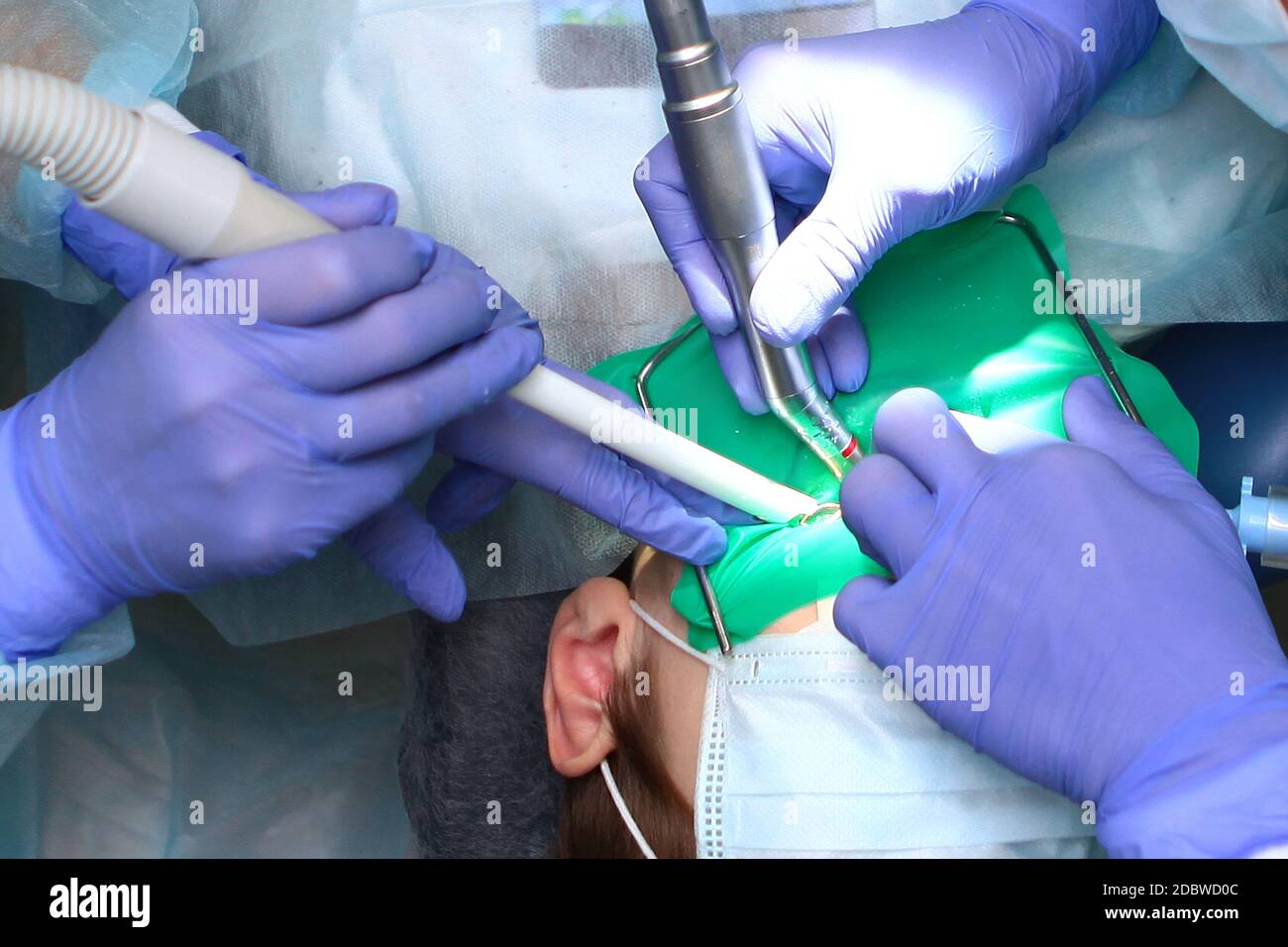 Chirurgia dentale per il trattamento di carie profonde in un bambino. Funzionamento in anestesia generale. La vista dall'alto. Spazio di copia. Foto Stock