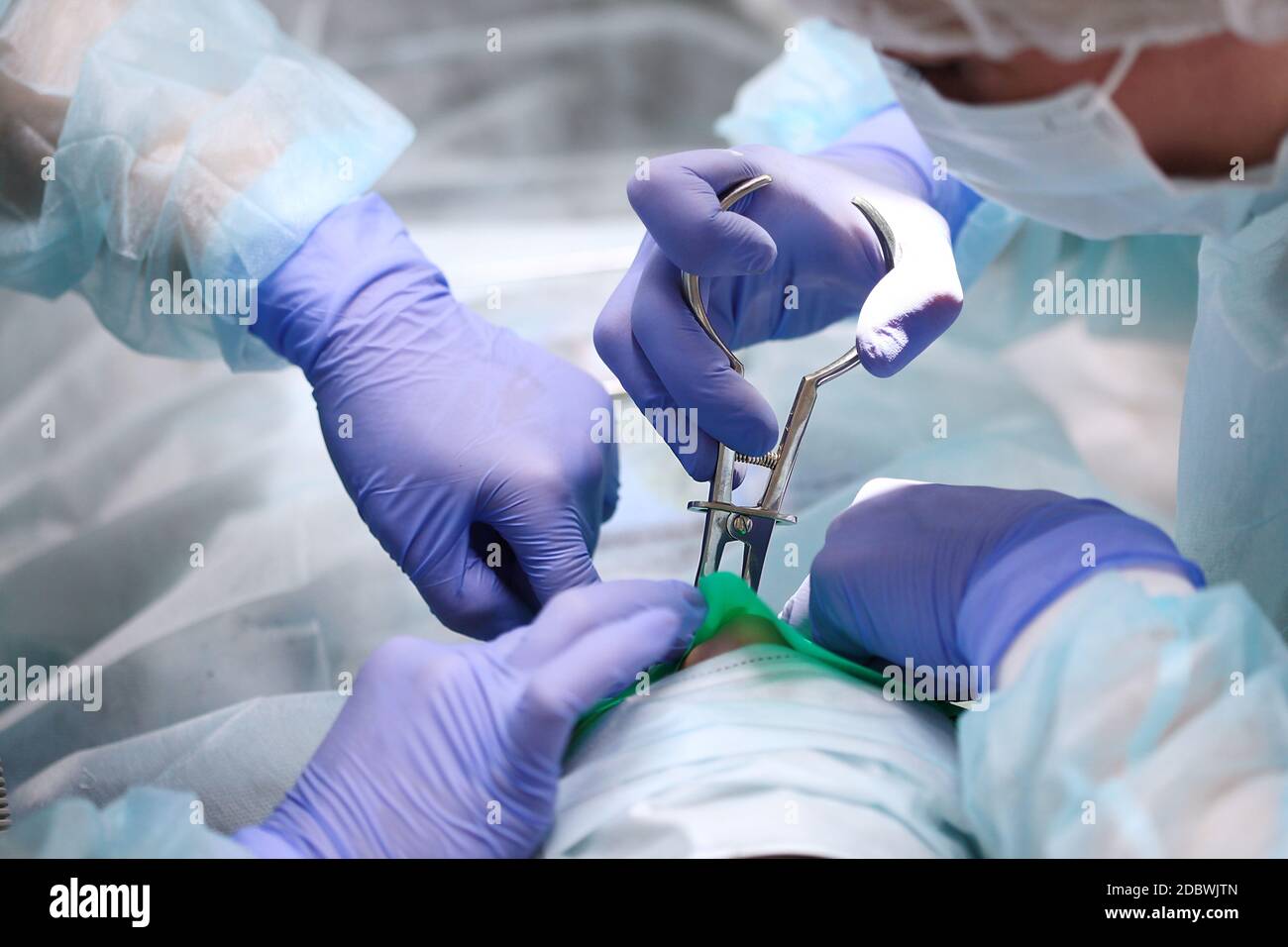 Rimozione delle carie in anestesia generale in un bambino. Le mani di un dentista in guanti.Copia spazio. Foto Stock