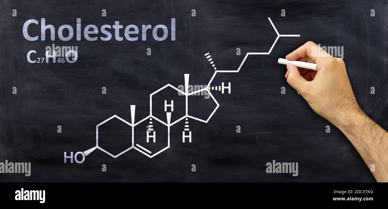 Formula chimica strutturale del colesterolo, disegno a mano con un gesso su una lavagna, classe chimica della scuola. Foto Stock