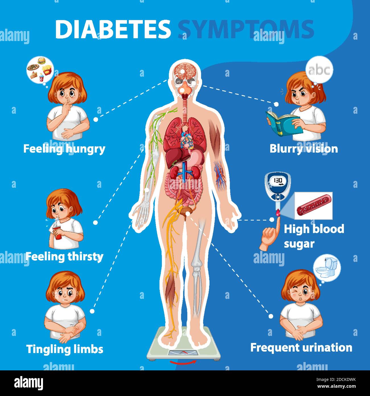 Informazioni sui sintomi del diabete illustrazione infografica Illustrazione Vettoriale