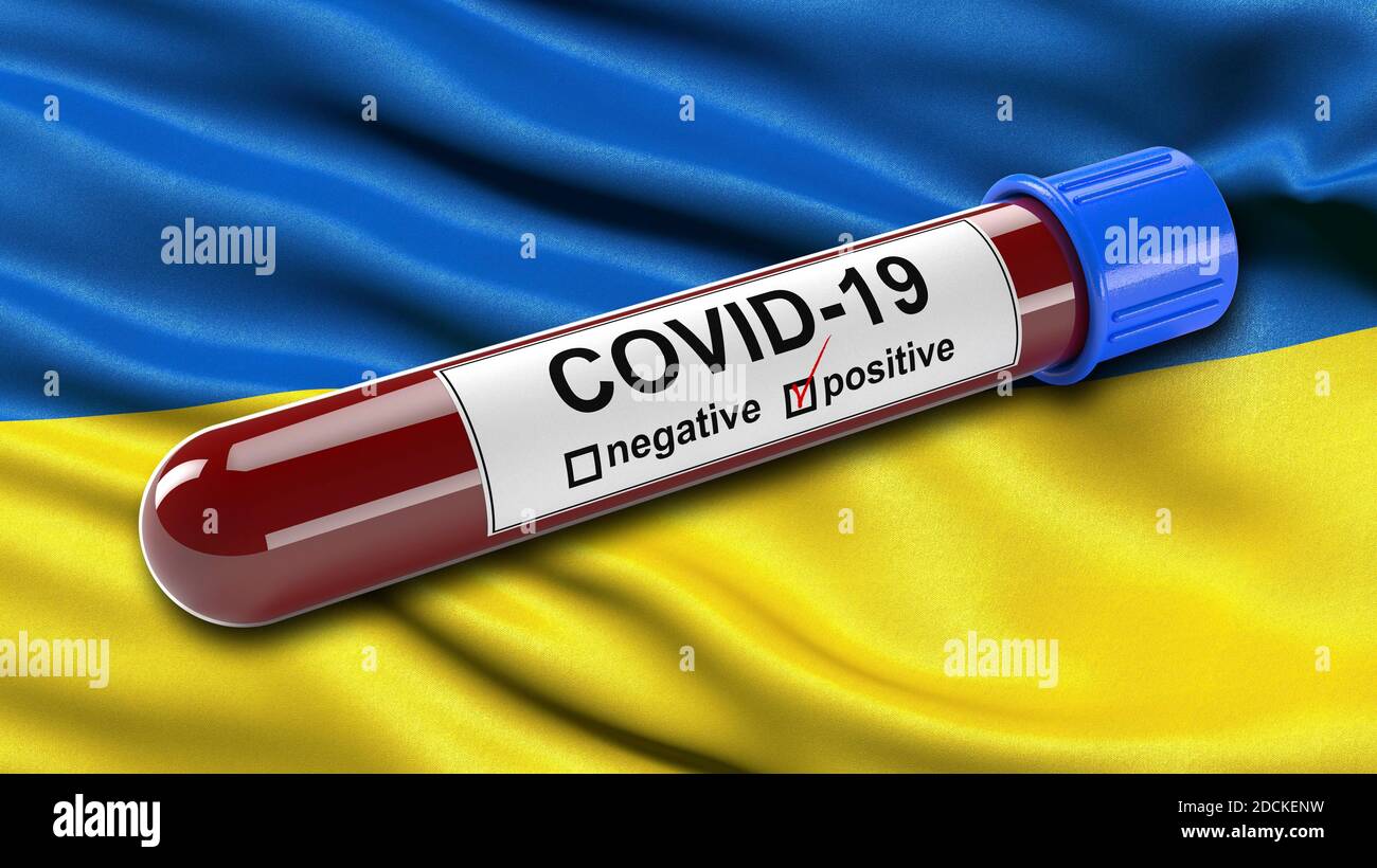 Bandiera dell'Ucraina che sventolava nel vento con una provetta per analisi del sangue COVID-19 positiva. Illustrazione 3D Foto Stock