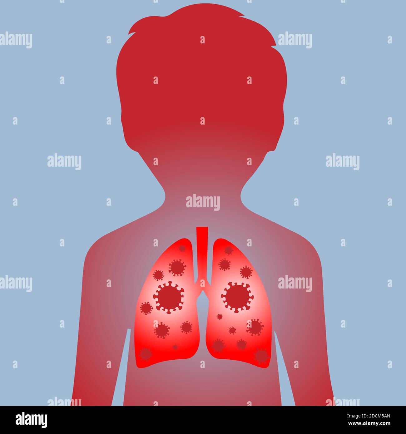 La silhouette di un bambino con polmoni infetti da covidi Illustrazione Vettoriale