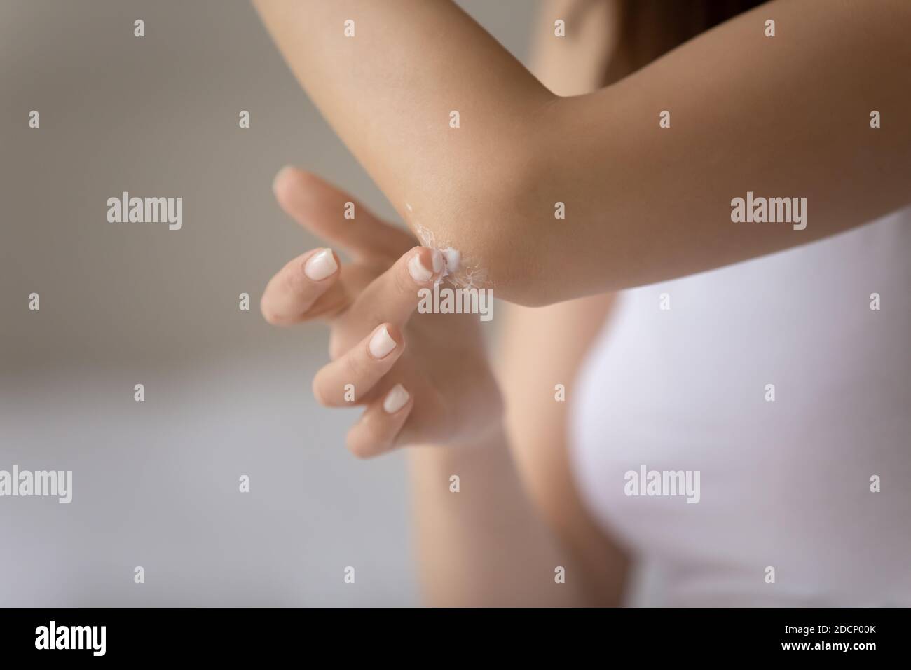 Donna millenaria che applica crema corpo su pelle ruvida su gomito Foto  stock - Alamy