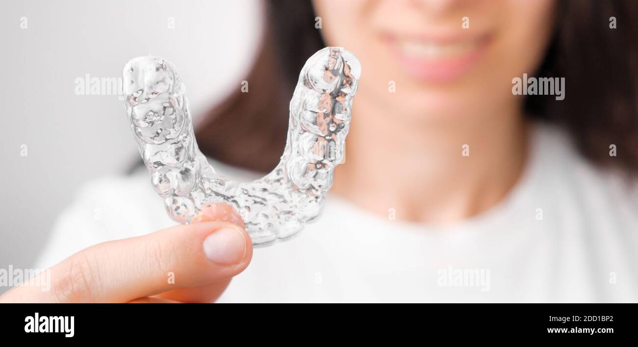 Primo piano aligner ortodontico trasparente in mano womans. Rinforzi rimovibili. Foto Stock