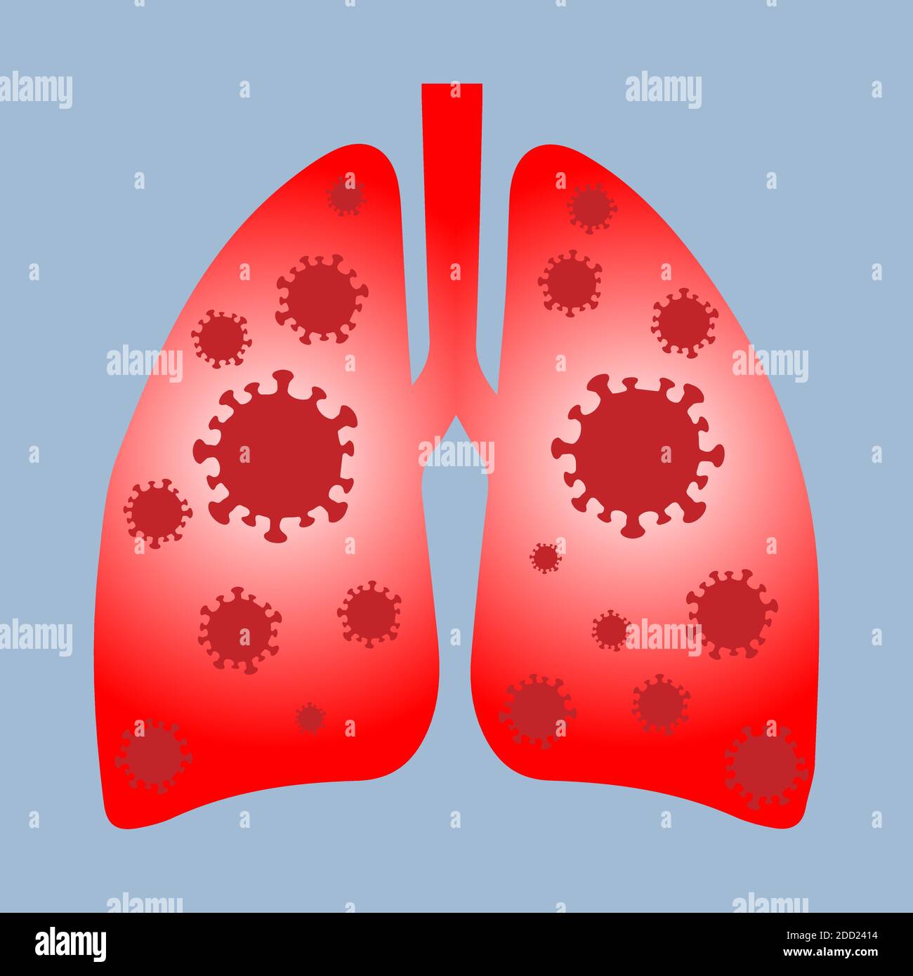 Polmoni umani infettati con coronavirus, vettore concettuale Illustrazione Vettoriale