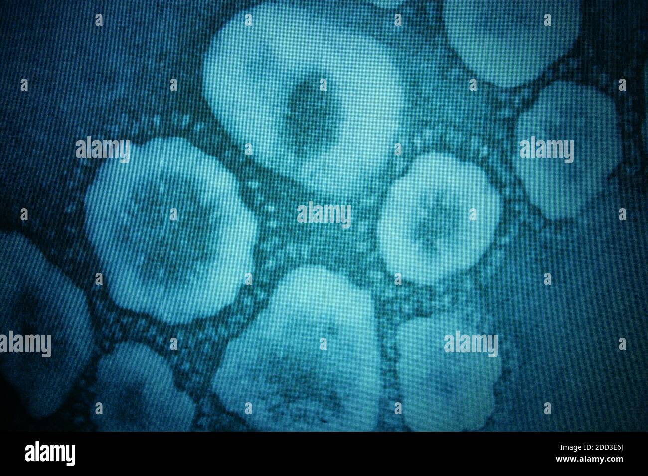 Canada / Winnipeg / SCHAH /Centro scientifico per la salute umana e animale/ micrografia elettronica del virus della corona . Foto Stock