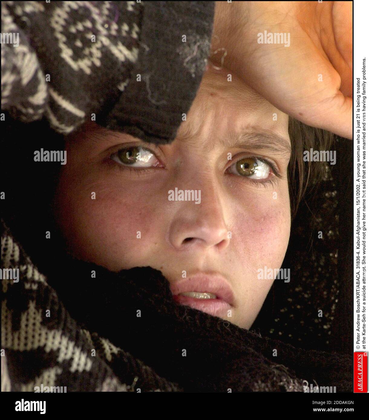 NESSUN FILM, NESSUN VIDEO, NIENTE TV, NESSUN DOCUMENTARIO - © PETER ANDREW BOSCH/KRT/ABACA. 31836-4. Kabul-Afghanistan, 15/1/2002. Una giovane donna di soli 21 anni viene curata al Karte-SEH per un tentativo di suicidio. Non avrebbe dato il suo nome ma ha detto che era sposata e stava avendo problemi di famiglia. Foto Stock