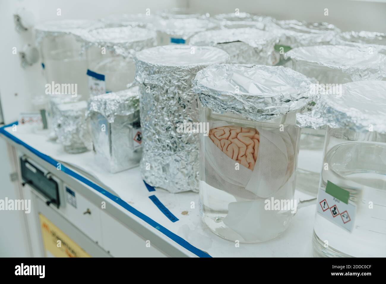 Becher cerebrali umani conservati sul tavolo in laboratorio Foto Stock