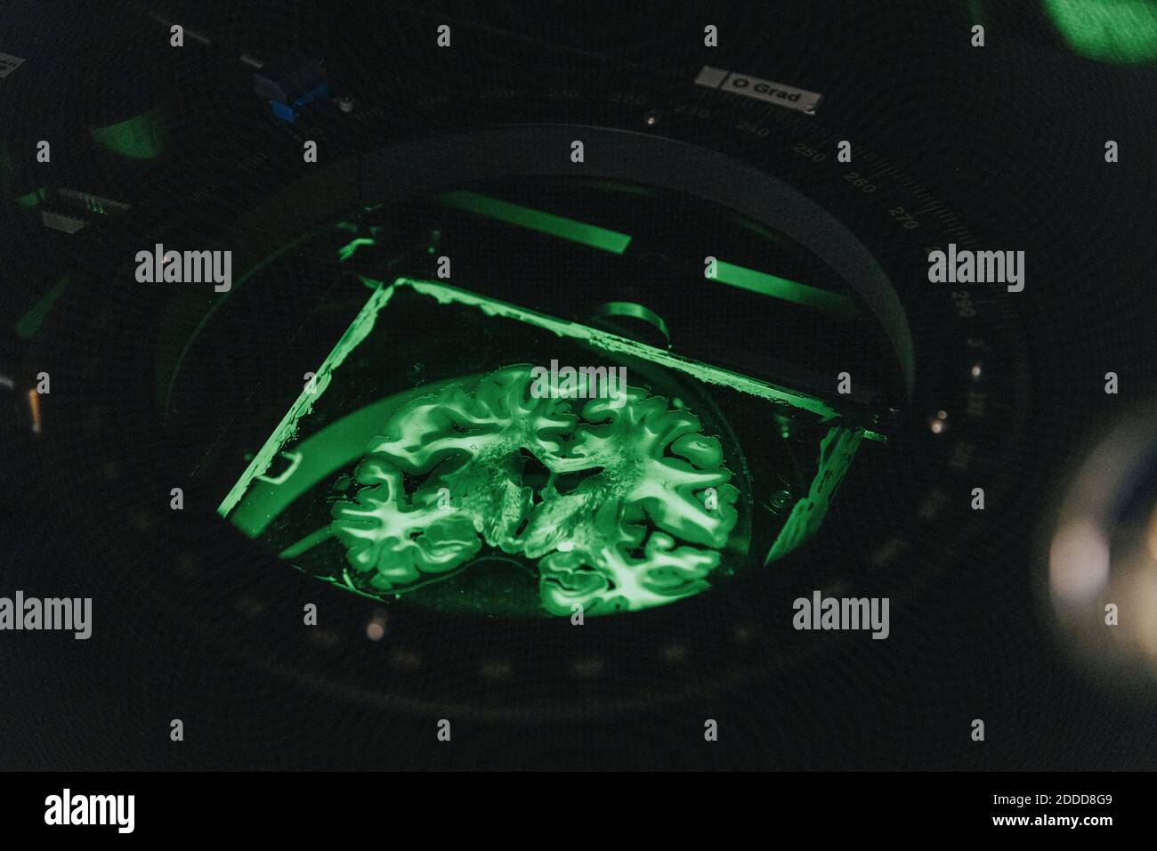 Vetrino cerebrale umano al microscopio illuminato in laboratorio Foto Stock