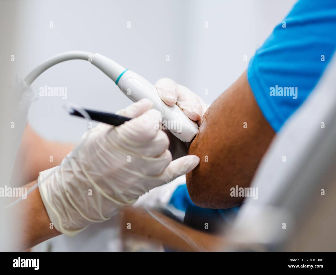Medico tagliato irriconoscibile in guanti di lattice che inserisce l'ago e l'uso sonda laser per guarire il gomito del paziente raccolto durante la fisioterapia sessione in mod Foto Stock
