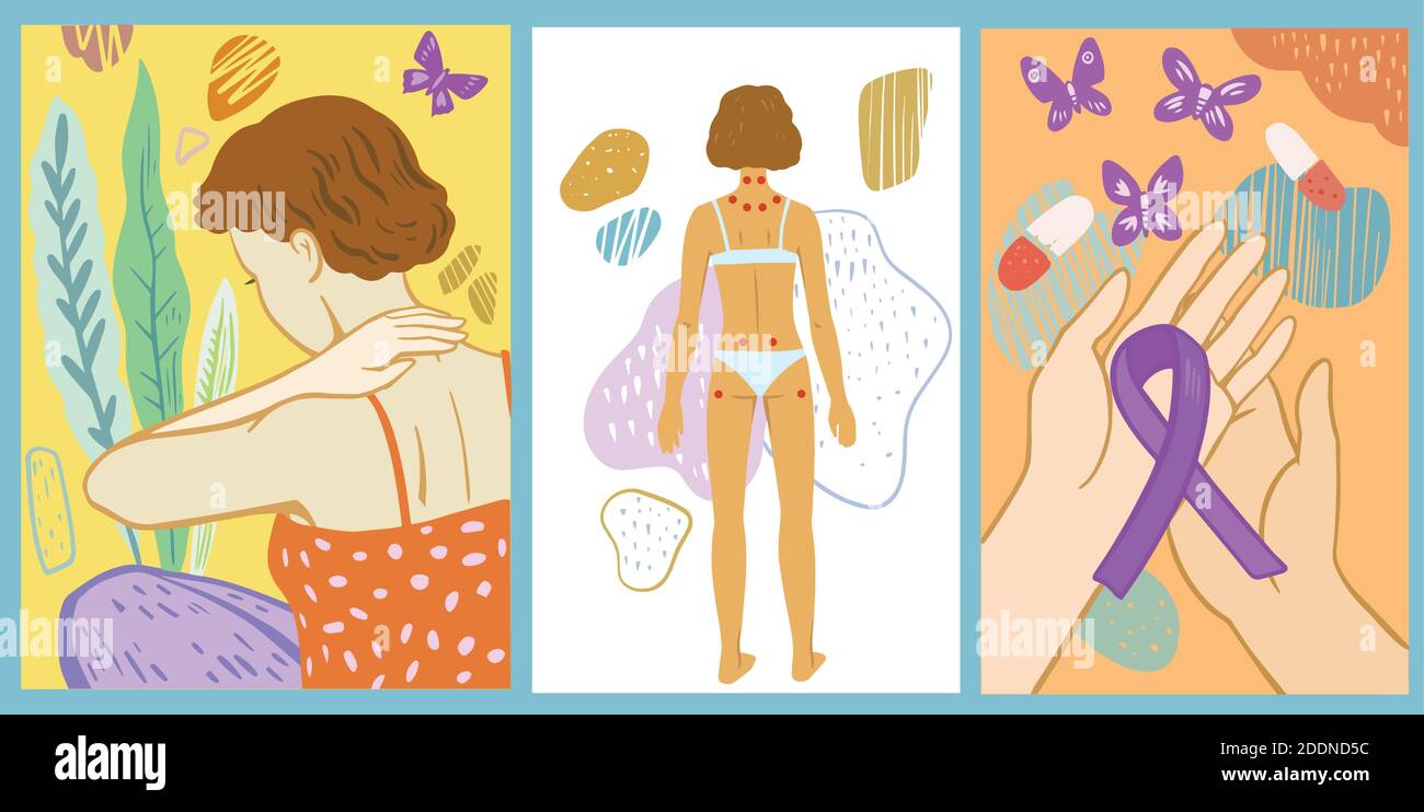 Serie di illustrazioni vettoriali sulla fibromialgia. Simbolo della fibromialgia. Dolore cronico e punti teneri. Illustrazione Vettoriale